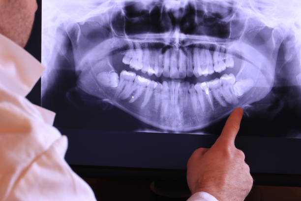 Best Dental Abscess Treatment in Redland, MD